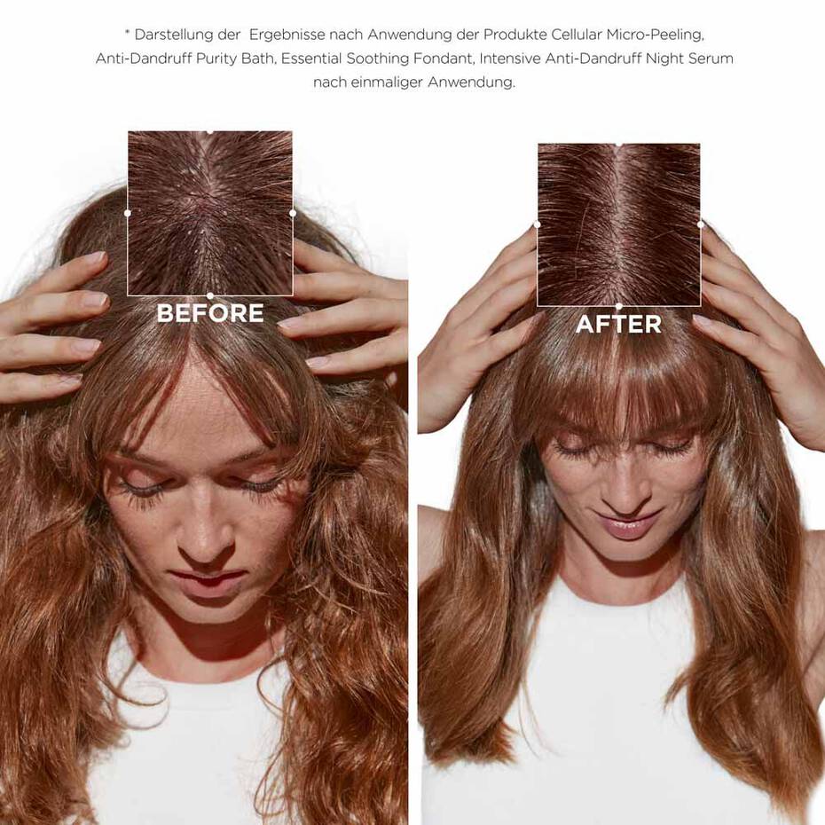 SYMBIOSE Bain Crème Anti-Pelliculaire Shampoo Kerastase