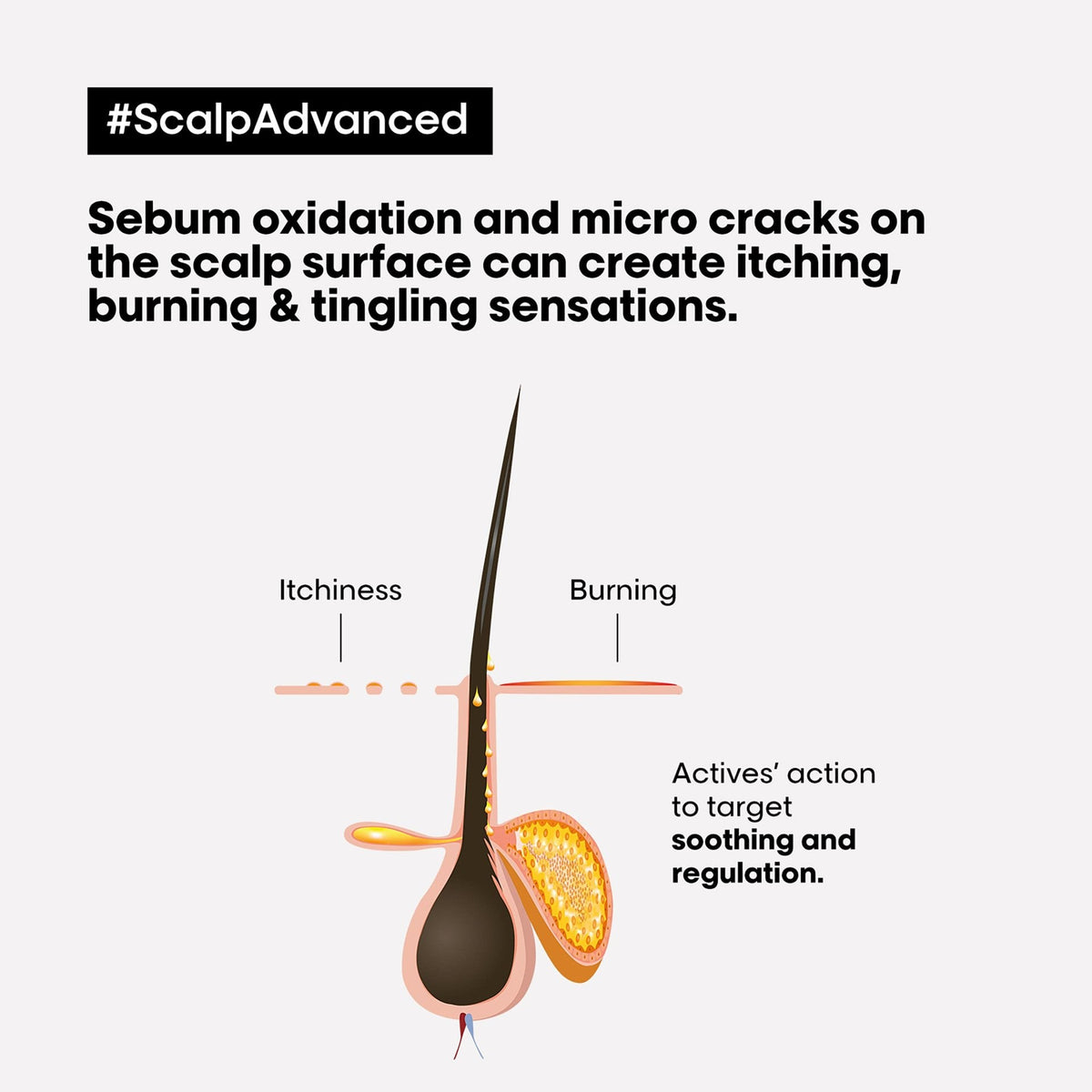 L’Oréal Professionnel SCALP ADVANCED Anti-Discomfort Treatment: Herstellerdarstellung empfindlicher Kopfhaut